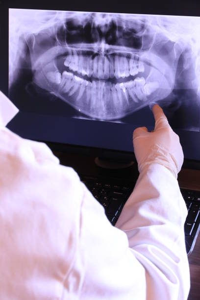 Best Emergency Treatment for Dental Infections or Abscesses in Conshohocken, PA